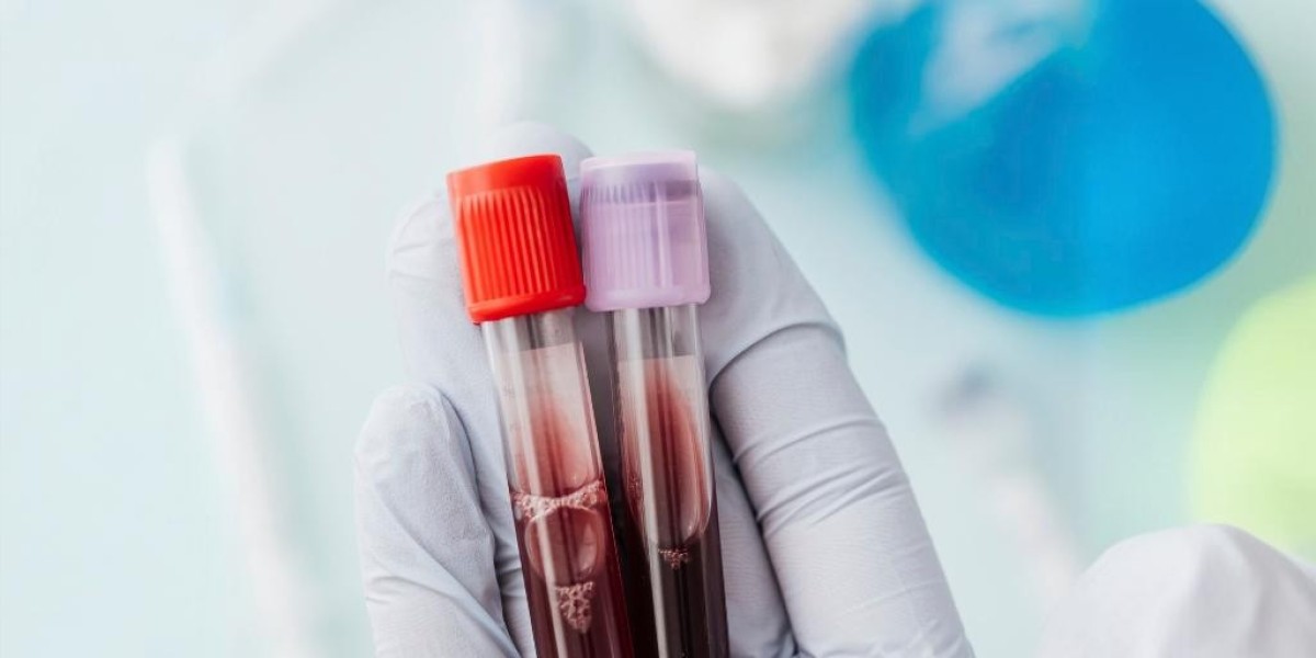 Blood Collection Tubes Market Research: Exploring Growth Drivers and Market Dynamics
