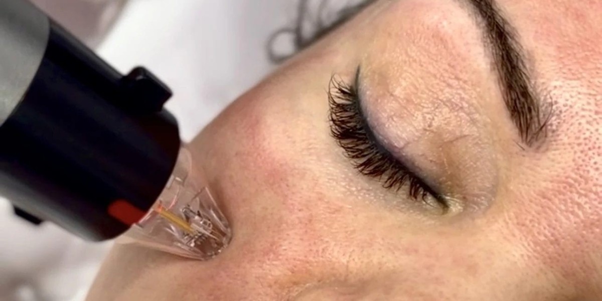 Wake up to perfect skin with Dubai’s advanced microneedling technology