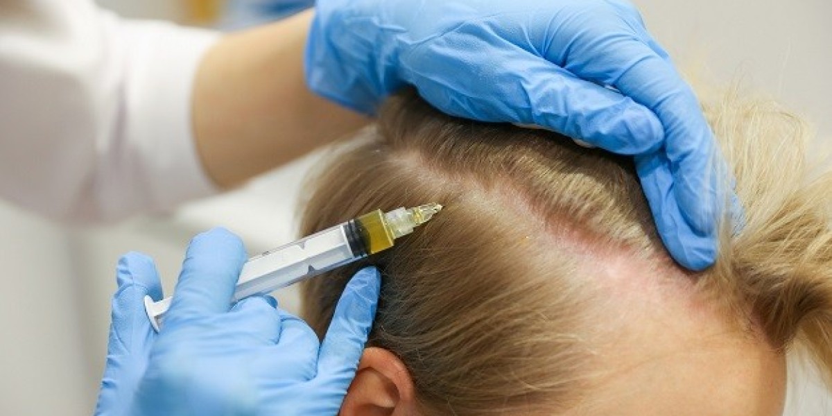 Will Transplanted Hair Grow Naturally Over Time? A Comprehensive Guide