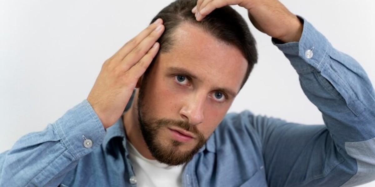 Hair Loss No More: The Science Behind Finasteride Treatment