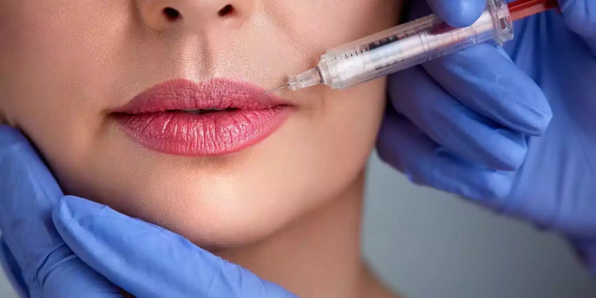 تخصيص علاج حقن الشفاه للحصول على ابتسامة مثالية