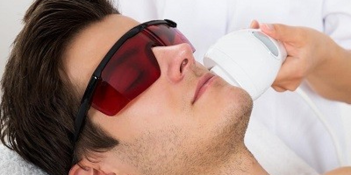 Is Laser Hair Removal Permanent?