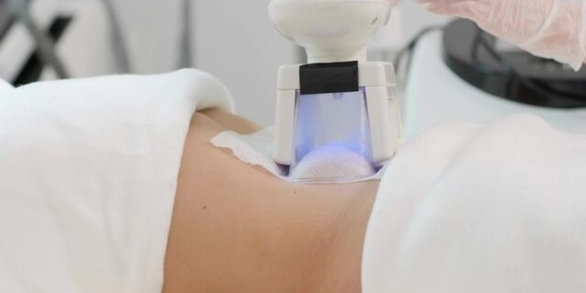 How Much Should You Budget for CoolSculpting in Dubai?