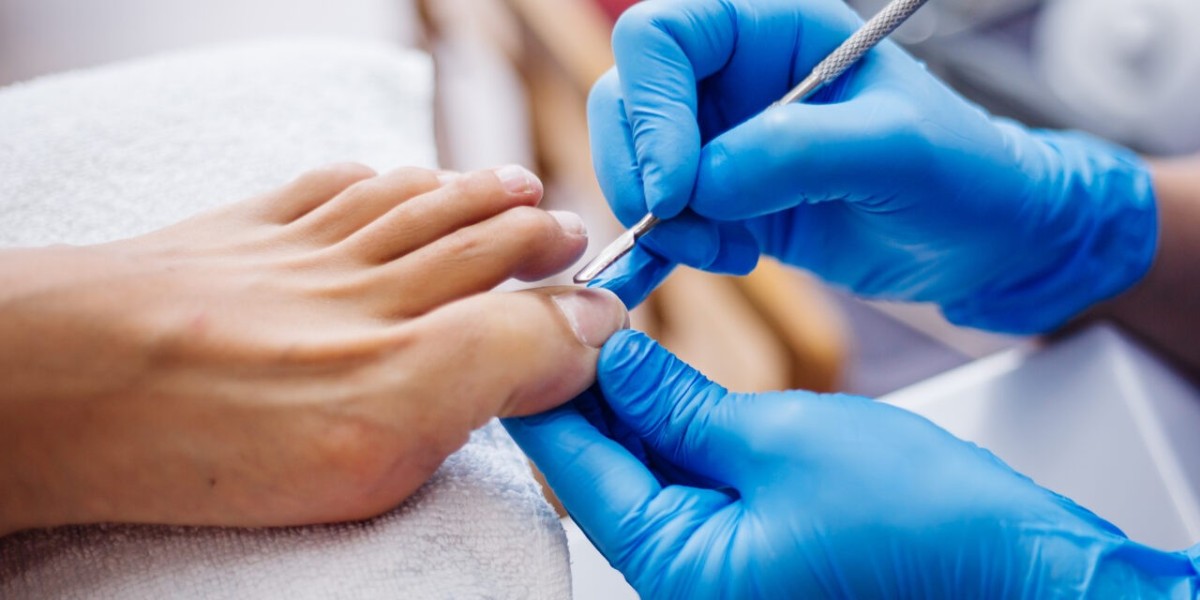 The True Cost of DIY Wart Removal: What You Might Be Overlooking