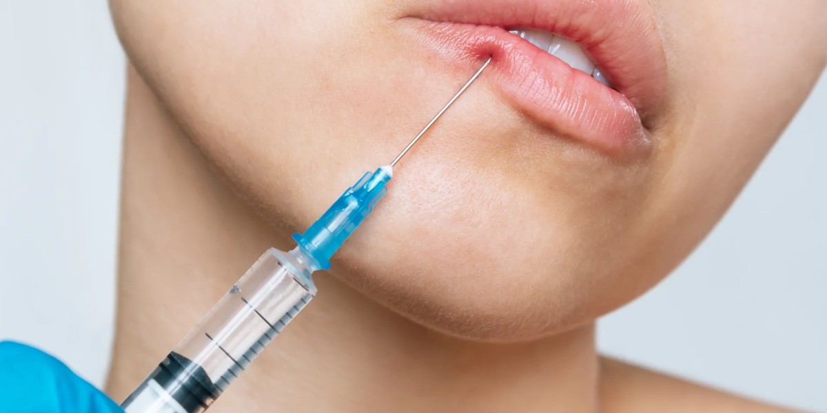 Elevating Beauty: Lip Fillers in Dubai