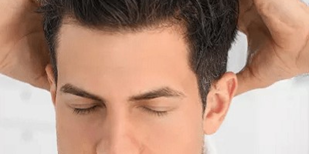 The Role of Finasteride in Hair Loss Management in Dubai