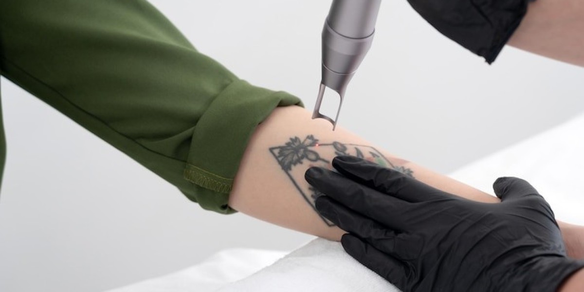 Is Laser Tattoo Removal Safe for Facial Tattoos?