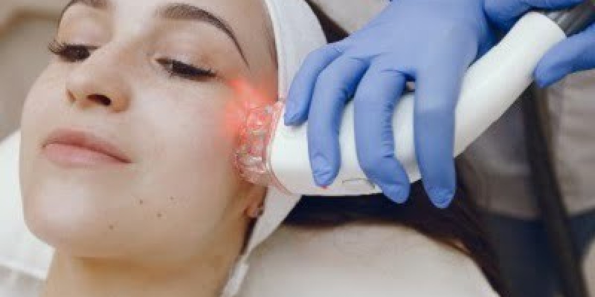 What Do Islamic Scholars Say About Laser Hair Removal?