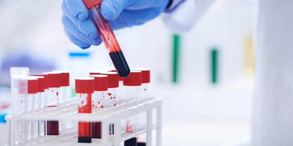UAE Clinical Laboratory Services: Addressing the Challenges of Lab Accreditation and Compliance
