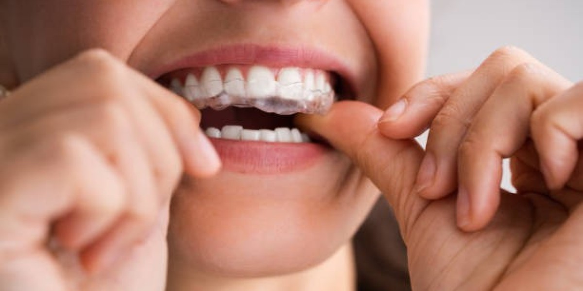 Why Everyone Loves Teeth Whitening Strips in Riyadh