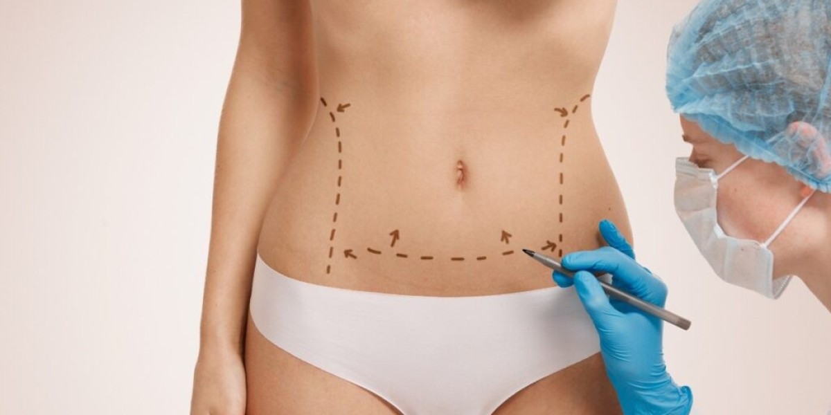 How Long Does Liposuction Surgery Take in Dubai?