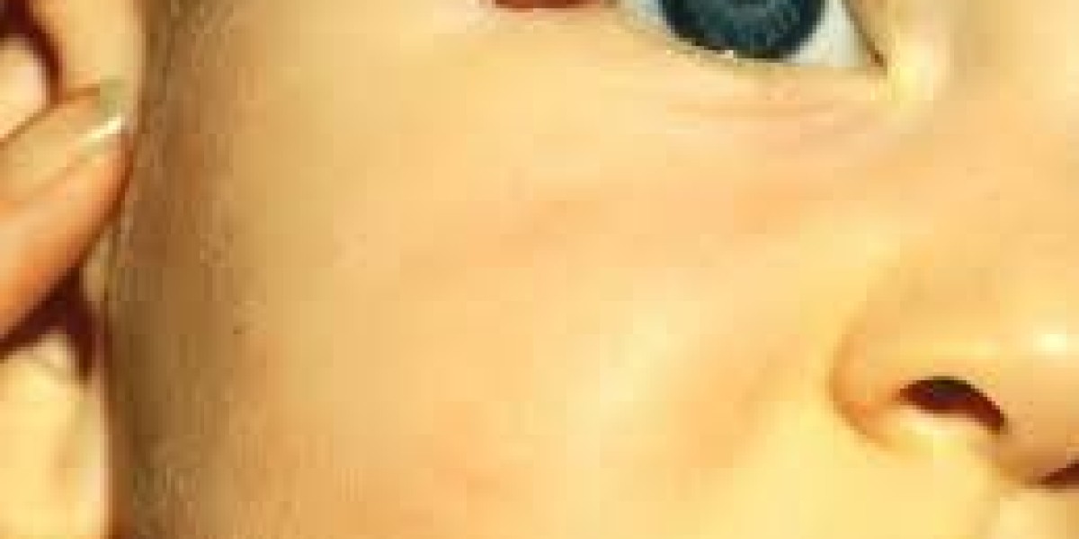 Is Laser Treatment Safe for Sensitive Skin?