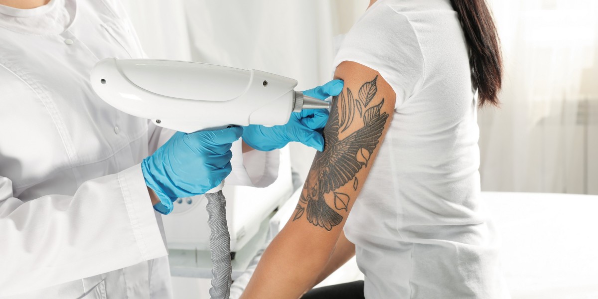 Why Laser Tattoo Removal in Dubai Is Perfect for Tattoos You Want Gone