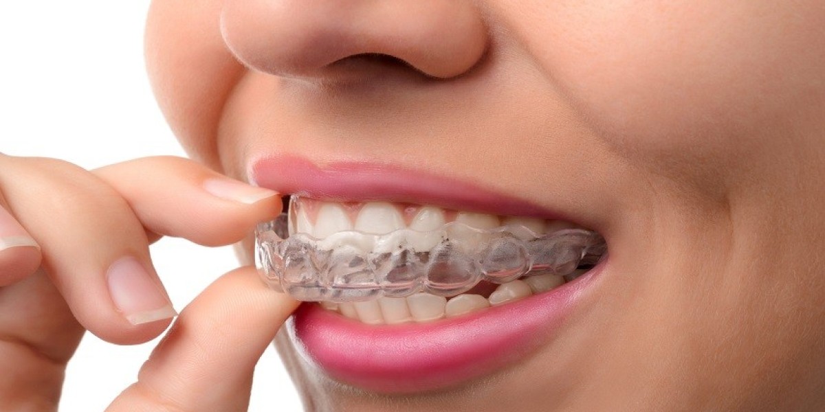 Can aligners fix shifted teeth?