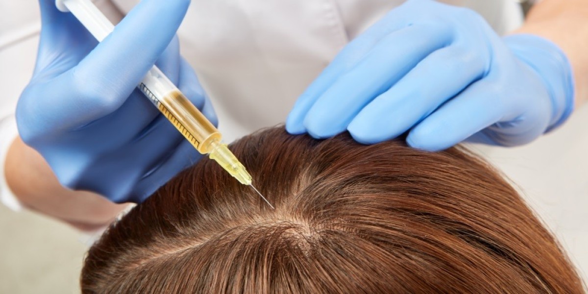 The Role of Finasteride in Hair Loss Management in Dubai