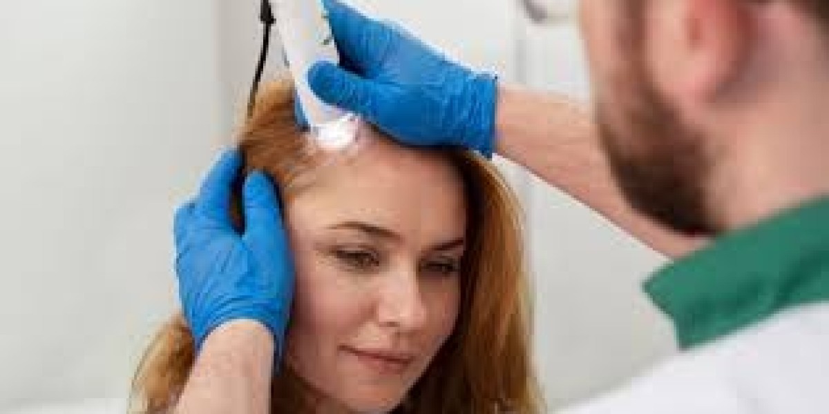 The Role of Finasteride in Hair Loss Management in Dubai