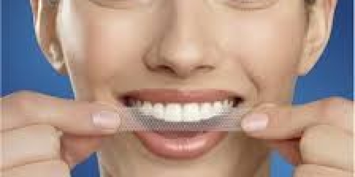 شرائط تبييض الأسنان في الرياض: الخيار الأفضل لمظهرك