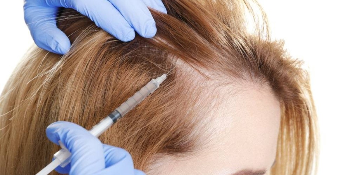 GFC Hair Transplant for Women in Riyadh: A Complete Guide