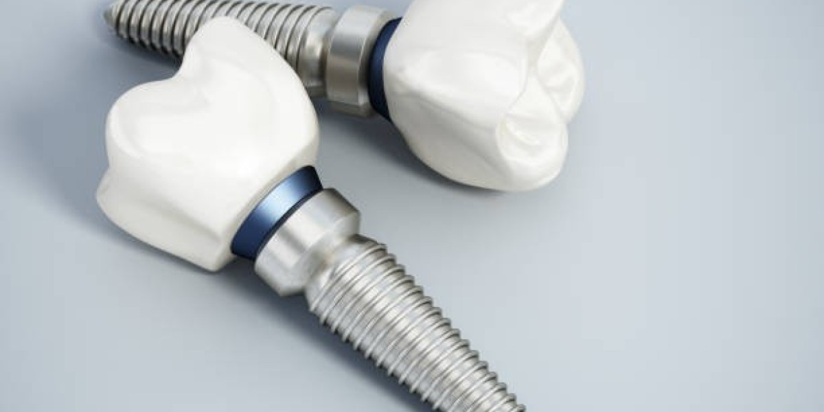 Affordable Teeth Scaling and Polishing Price in Karachi – Get the Best Rates Today!