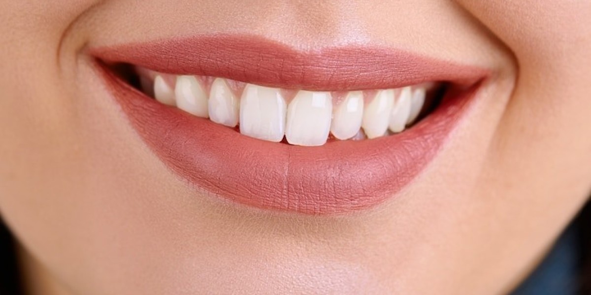 What Are the Most Effective Teeth Whitening Methods?