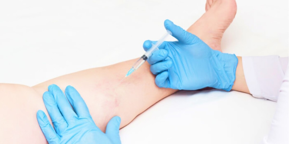 How Riyadh Clinics Address Spider Veins Effectively