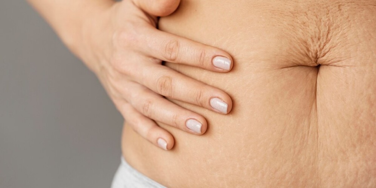 How is tummy tuck surgery performed?