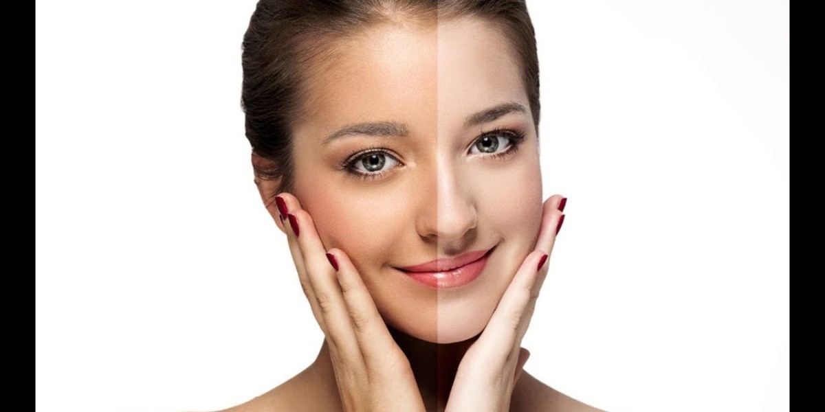Whitening Creams and Professional Treatments in Riyadh