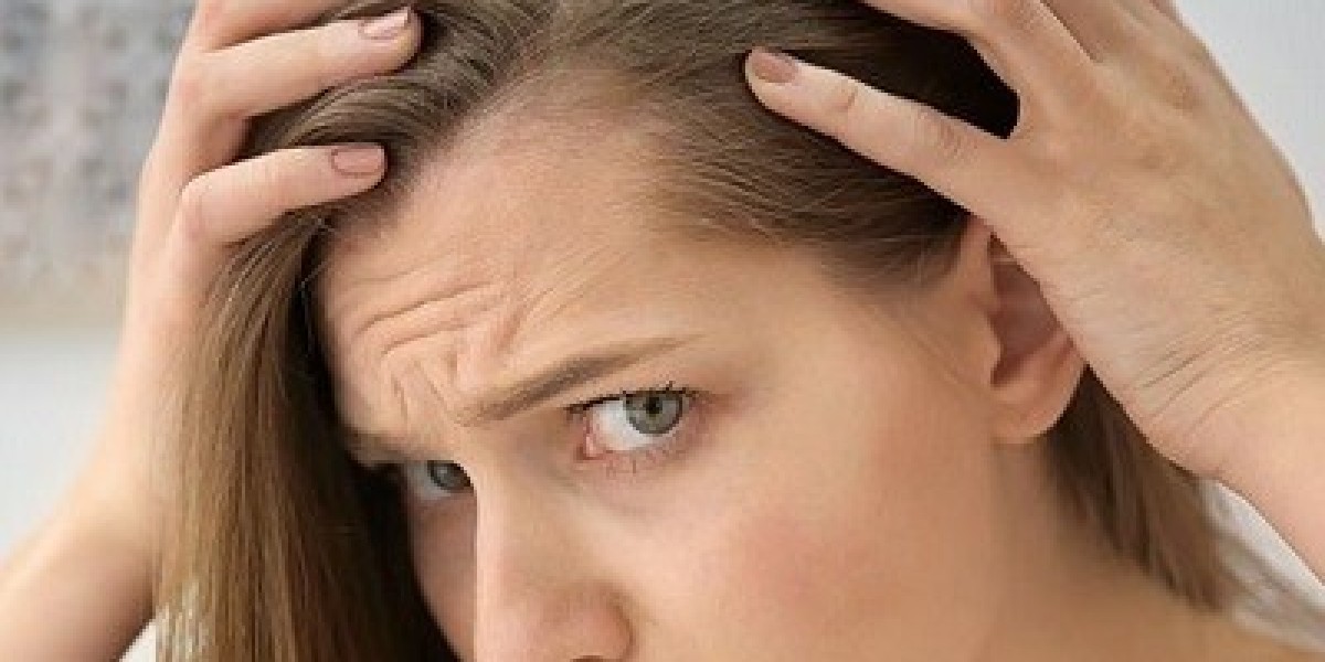 Transforming Hair Loss with Finasteride in Dubai