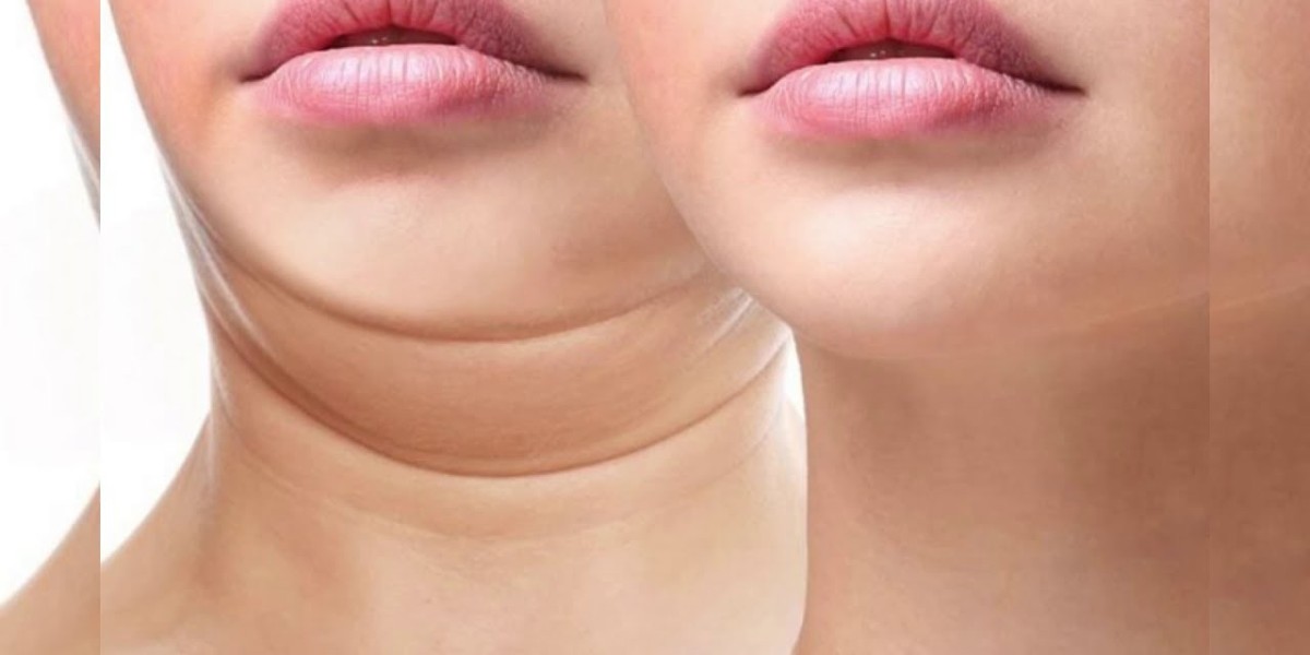 Surgical vs Non-Surgical Double Chin Removal in Riyadh