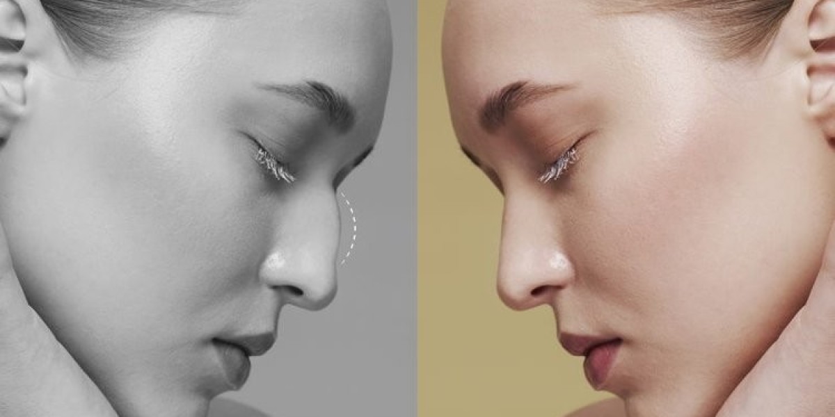 Balanced Beauty Starts Here – Dubai Rhinoplasty ?