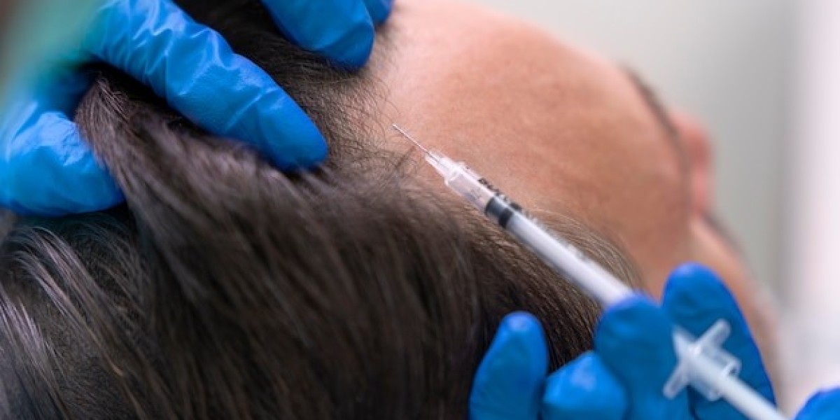 How PRP Hair Treatment Rejuvenates Aging Hair Follicles