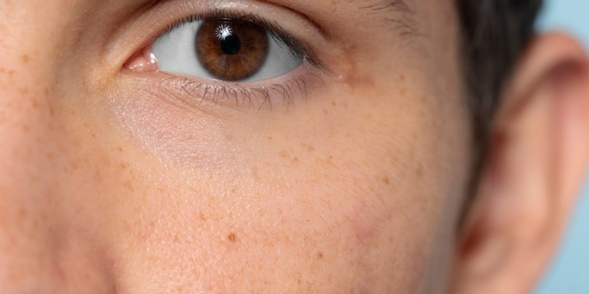 Can acne scar treatments improve skin texture?