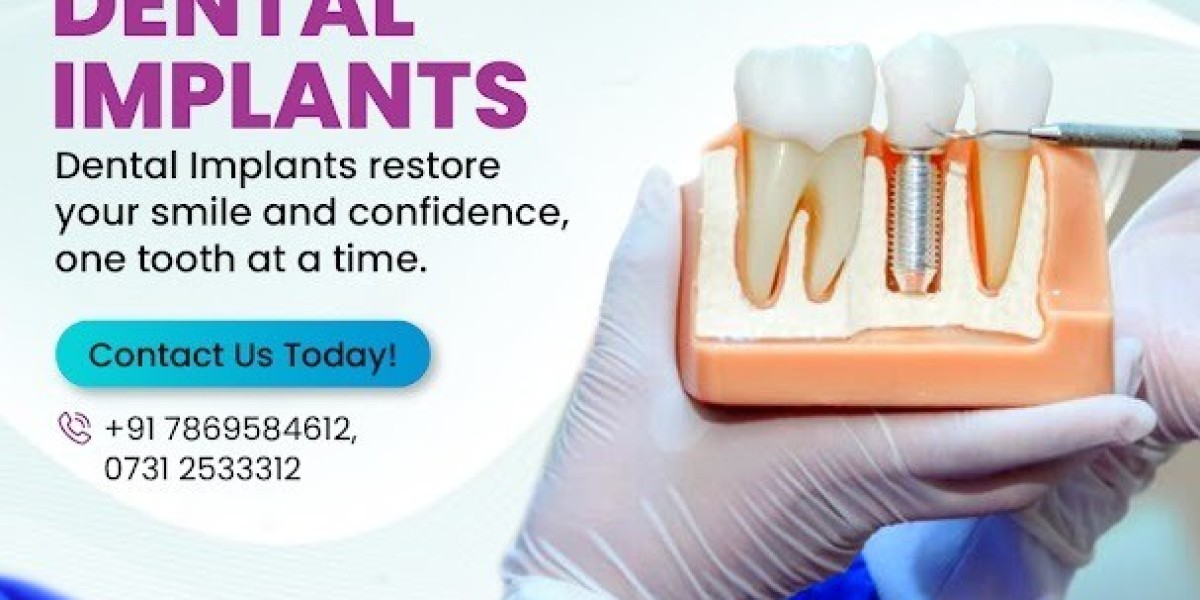 Dental Implants in Indore – Restore Your Smile with Dr. Rashmi Rathore Solanki