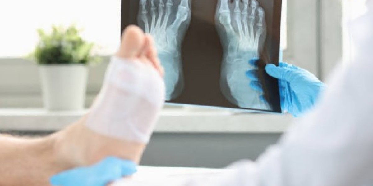 Advanced Ankle Fracture Treatment in Lahore at Ortho Center