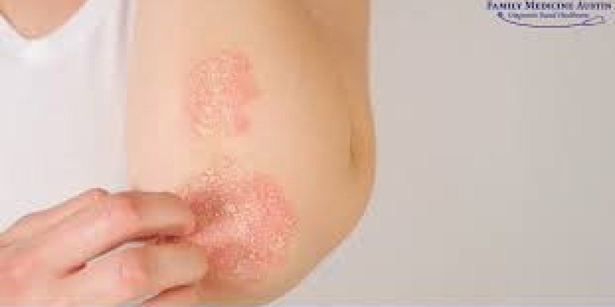 The Role of Skin Infection Antibiotics in Modern Skincare