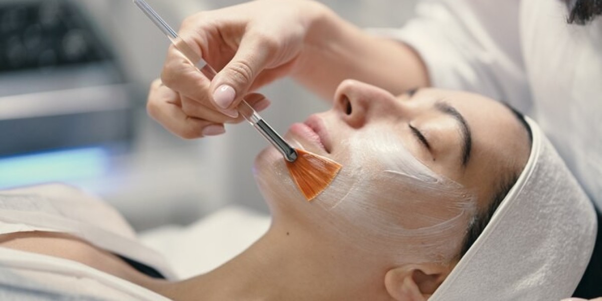What Makes Chemical Peels a Popular Skincare Treatment?