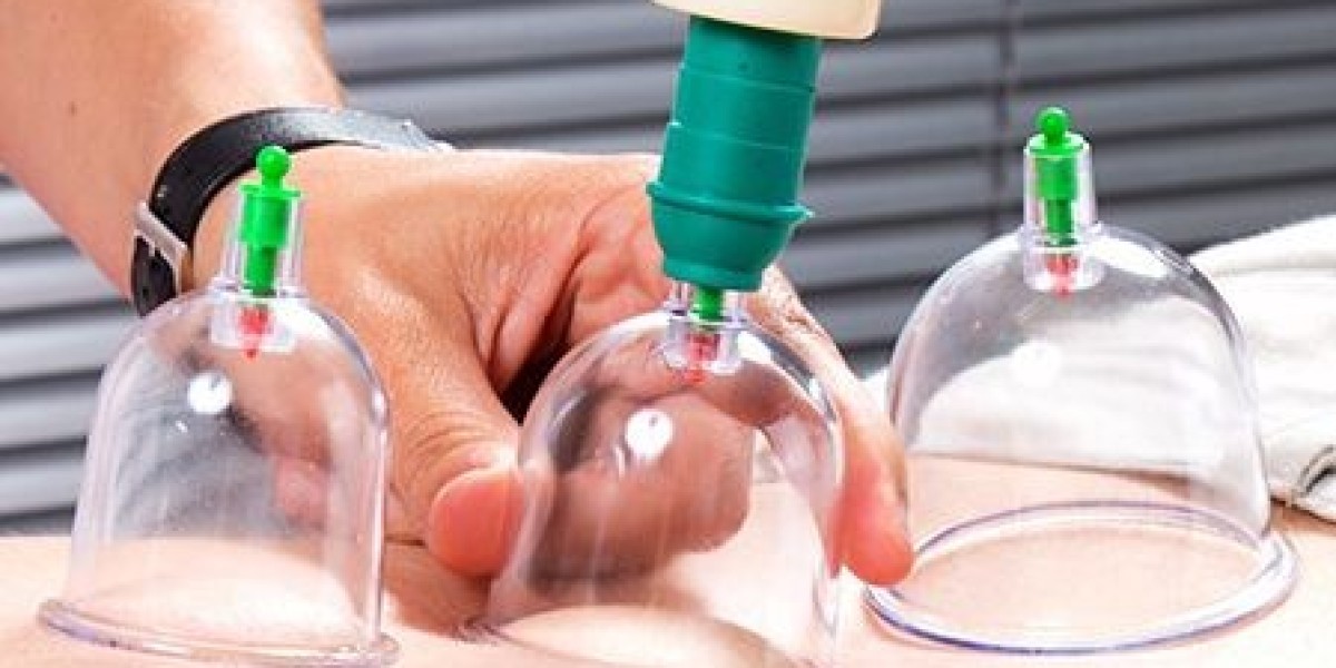أفضل المراكز النسائية للحجامة في الرياض: خدمات مميزة وأمان