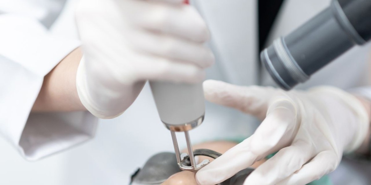 How to Get Rid of Stubborn Pigmentation with Pico Laser