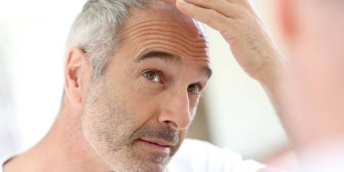 What Is Hair Transplant Success Rate?