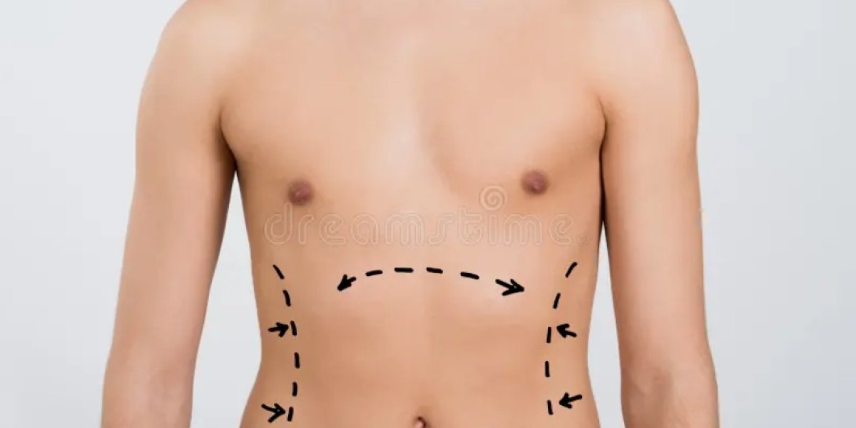 A Beginner’s Guide to VASER Liposuction in Riyadh