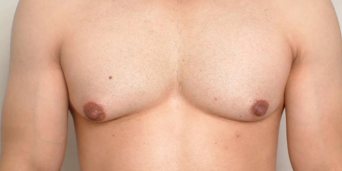 How to Reduce Gynecomastia Through Exercise?