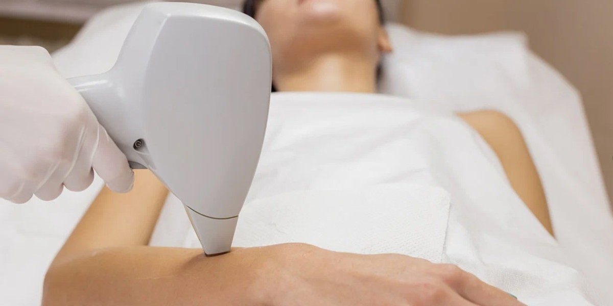 Customized Laser Hair Removal Plans in Riyadh