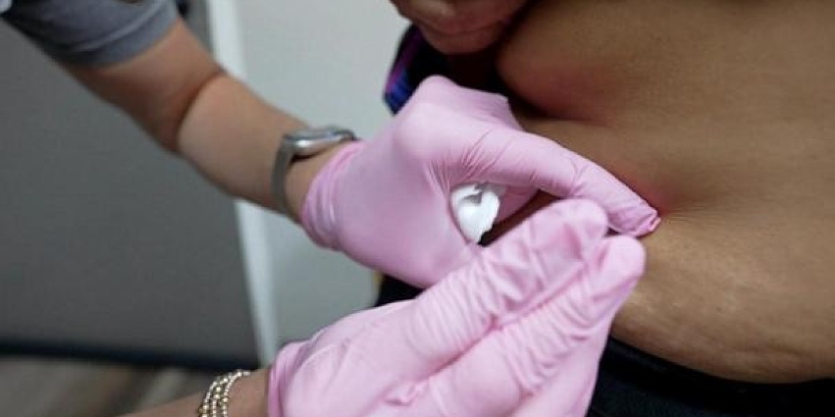A Step-by-Step Guide to Starting Weight Loss Injection Therapy