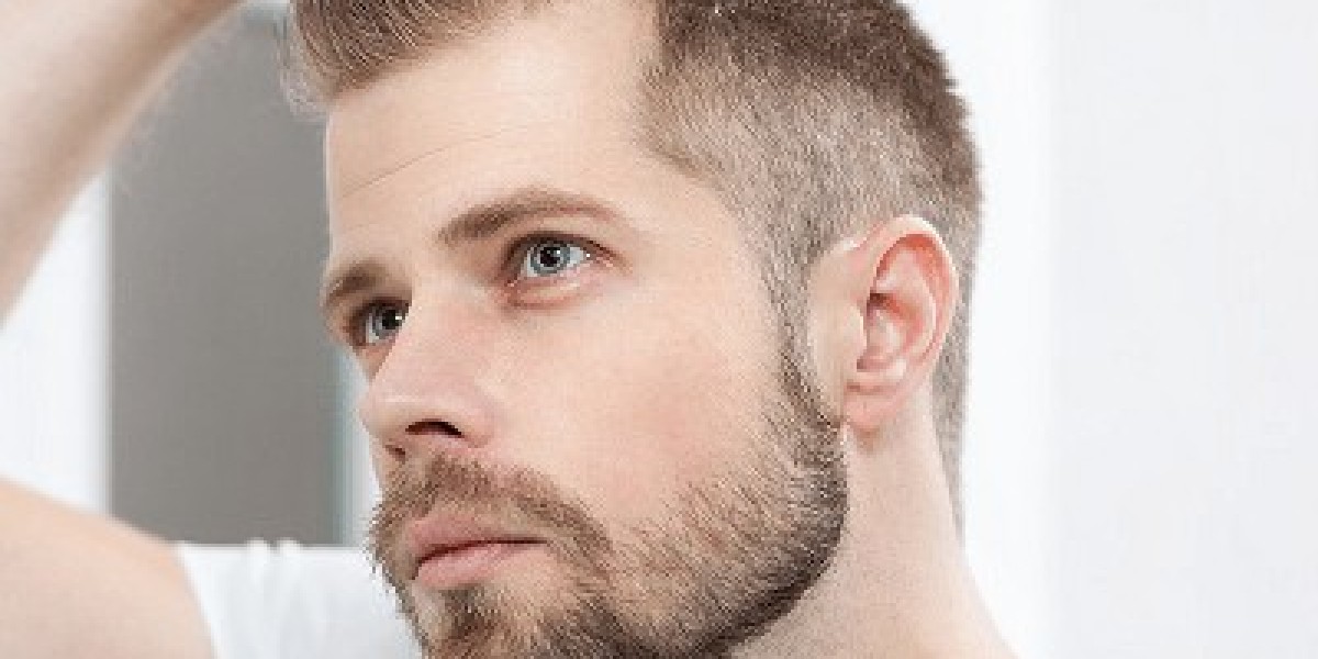 Regrowing Hair with Finasteride: What You Need to Know