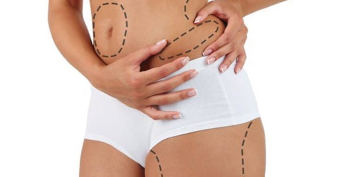 Can Liposuction in Dubai Help You Achieve a More Sculpted Figure?