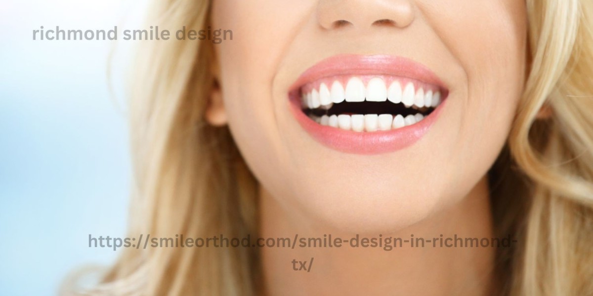 How to Choose the Best Dentist for Affordable Porcelain Veneers in Miami