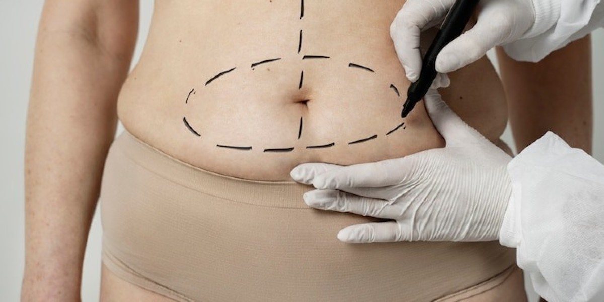 Who benefits from a tummy tuck?