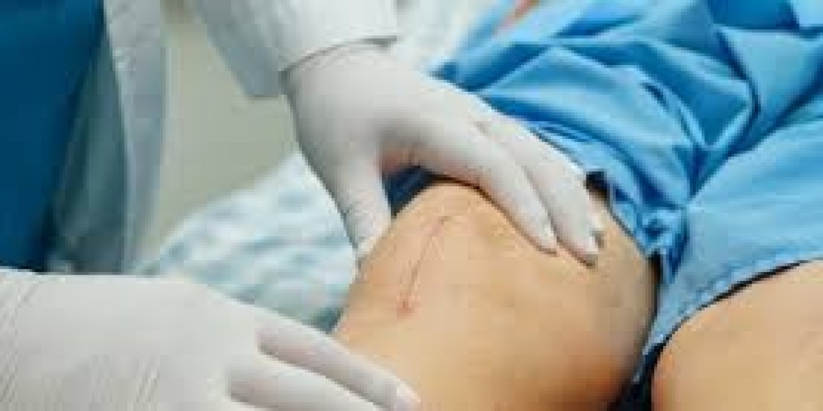 Embracing Your Scars: A Holistic Approach to Skin Health and Confidence