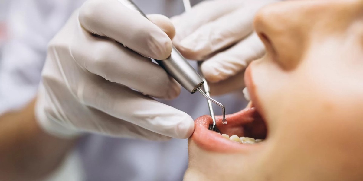 Tooth Extraction Costs Demystified: Are You Overpaying?