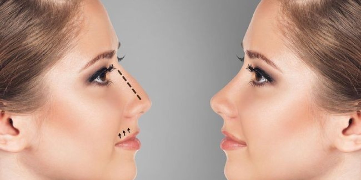 Non-Surgical Rhinoplasty in Dubai: A Growing Trend